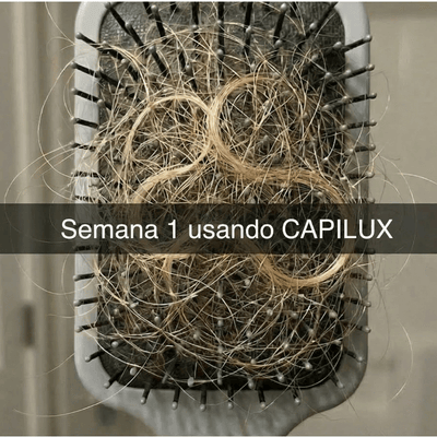 Escova cheia de cabelos na Semana 1 — queda intensa antes de melhorar